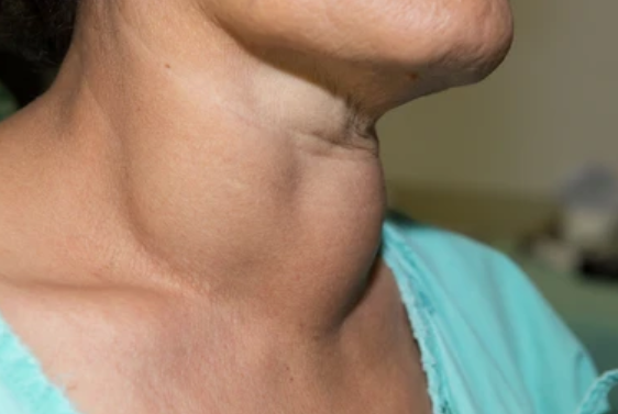 Close-up doctor with stethoscopee