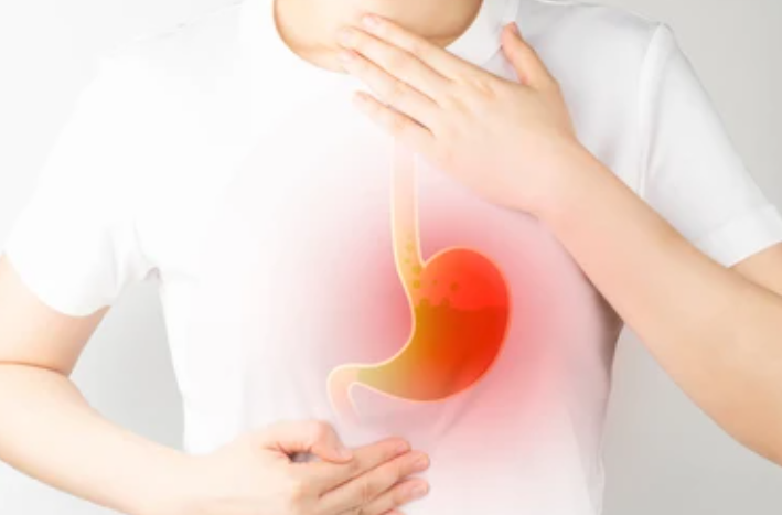Menjalani Puasa Ramadhan dengan Nyaman Bagi Penderita GERD