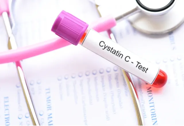 Cystatin C: Pengertian, Fungsi, dan Pentingnya dalam Menilai Kesehatan Ginjal